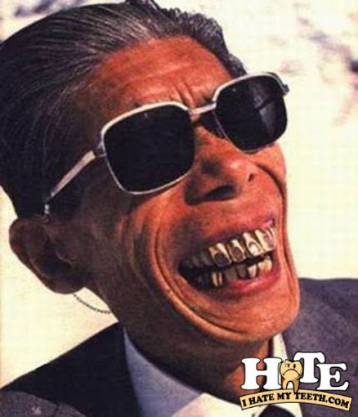 http://4.bp.blogspot.com/_YyXZ9LFygq0/TEQQDI8dNZI/AAAAAAAAAPQ/ynNzVF2Y8Jk/s1600/about_teeth_640_09.jpg