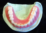 Denture