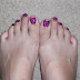 zebra toenails!