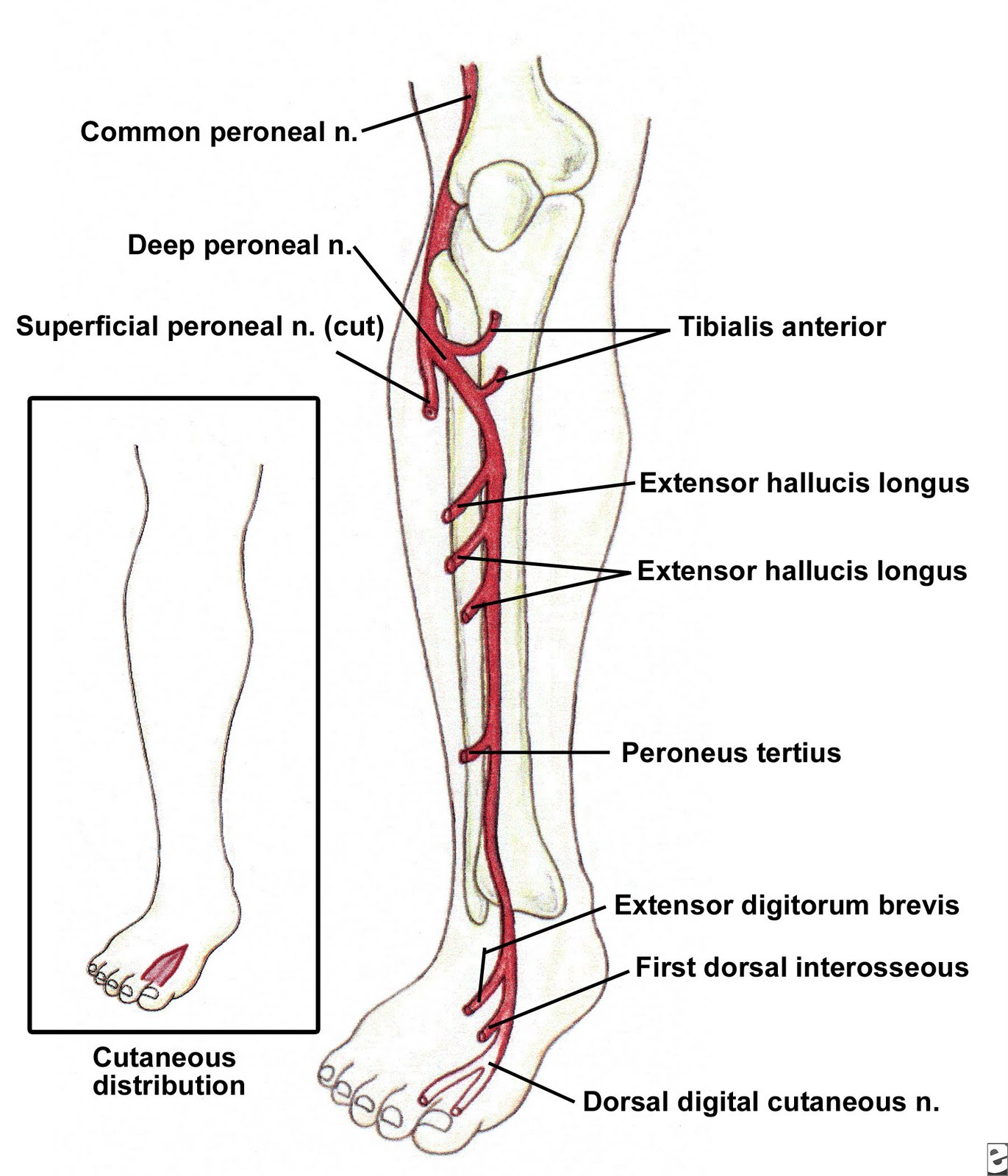 Doctors Gates: Foot Drop: causes and treatment