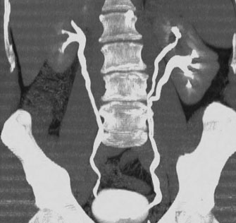 ct urography radiology phases