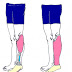 Hablemos de amputacion y Protesis (parte II: Transtibial - Desarticualcion de rodilla)