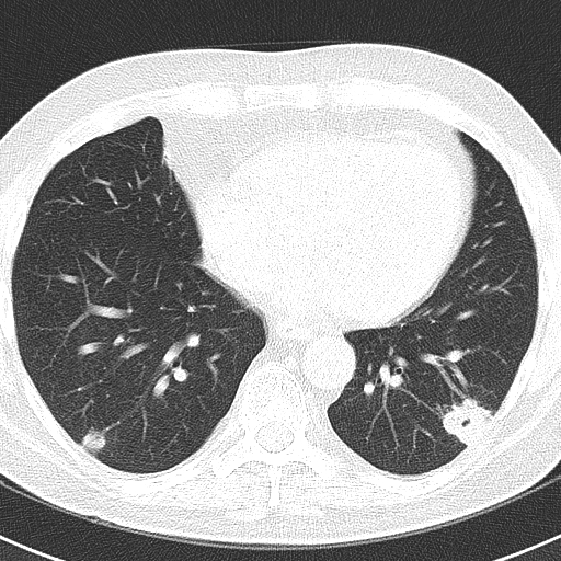 Leukologics Long time...