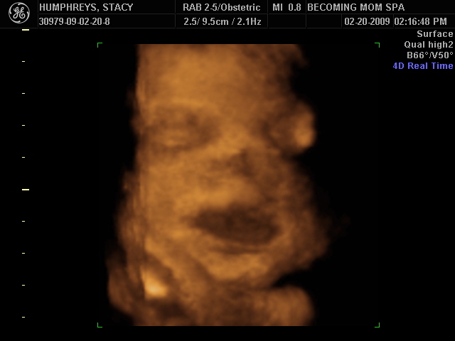 [BABY_16.JPG]
