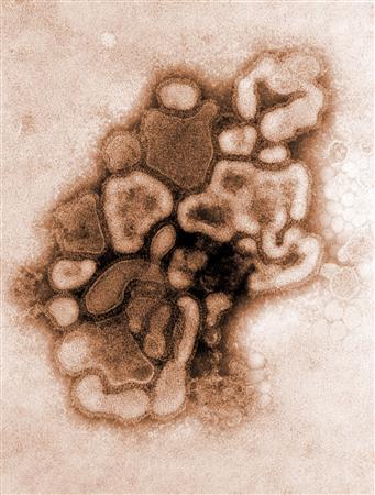 Grippe aviaire ou grippe porcine ... mais aussi et surtout grippe humaine