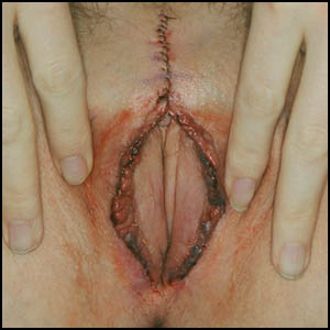 fuera de córneo sexo fuera de córneo sexo