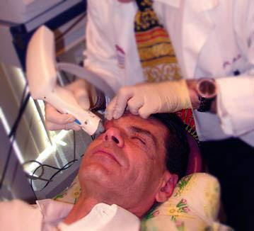Thermage Procedure