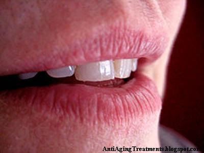 dermatitis lips