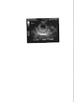 7 Week Ultrasound 6.12.08