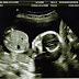 Second scan