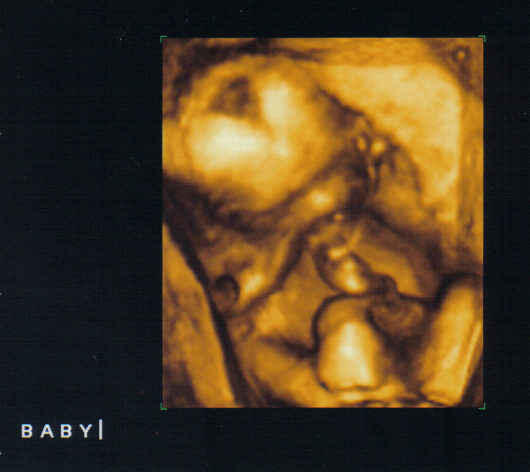 [Baby+Girl+Brown+2.jpg]