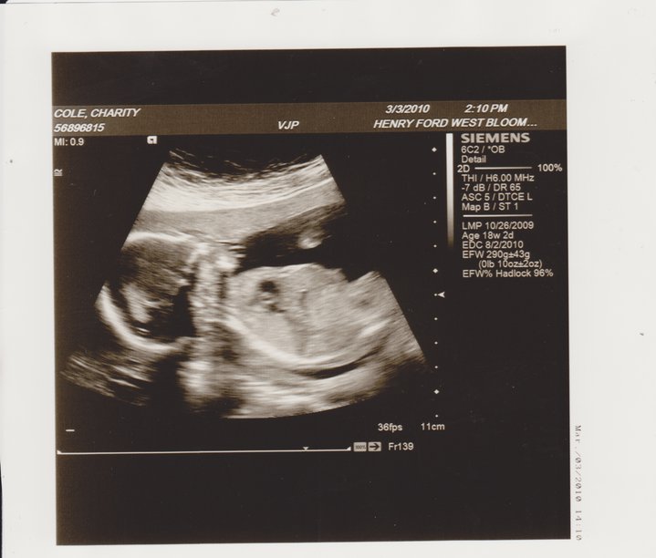 [baby+3+sucking+hand+head+to+left.jpg]