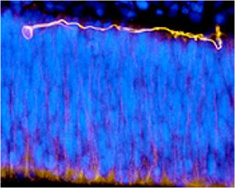 [neurona+predecesora.png]