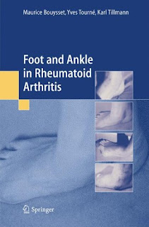 ortho+Foot+and+ankle+in+rheumatoid+arthritis.jpg