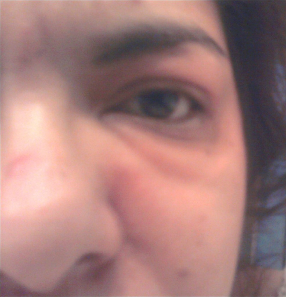 Dairy Allergies Simple.Beautiful.Life.