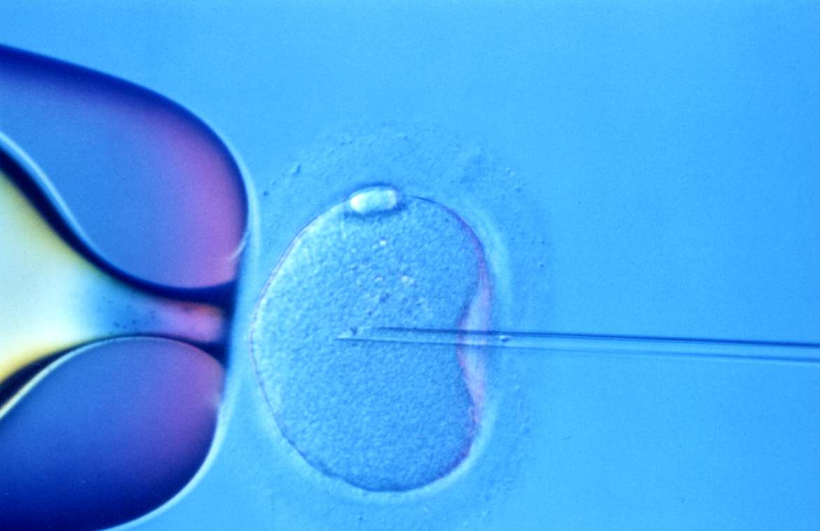 assisted reproductive techniques