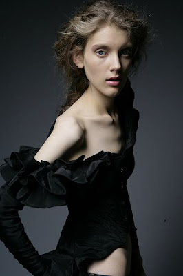 Famous Fashion Models With Eating Disorders Famous Fashion Models With Eating Disorders