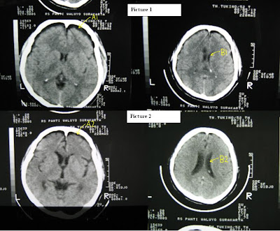Ct+scanner+block+diagram