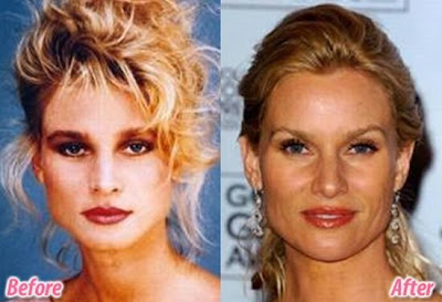 celebrity plastic surgery celebrity plastic surgery