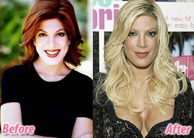 celebrity plastic surgery celebrity plastic surgery