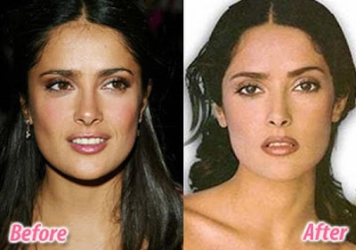 celebrity plastic surgery celebrity plastic surgery