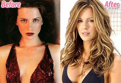 celebrity plastic surgery celebrity plastic surgery