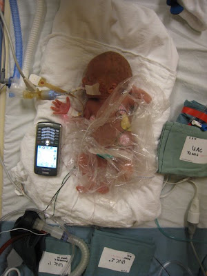 Micro Preemie Babies