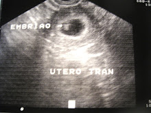 Meu amor com 6 semanas