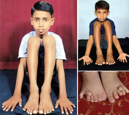 [fingers+and+toes.jpg]