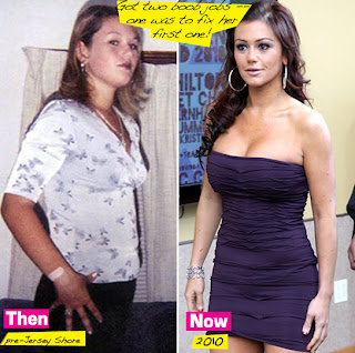 Jwoww    Plastic Surgery on Had A Breast Augmentation However After Old Photos Of Jwoww Surfaced
