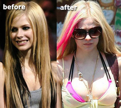avril lavigne images. Avril Lavigne Breast Implants