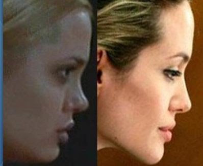 angelina jolie plastic surgery photos. Angelina Jolie Nose Job