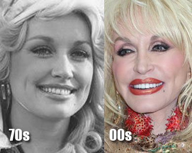 dolly parton plastic surgery