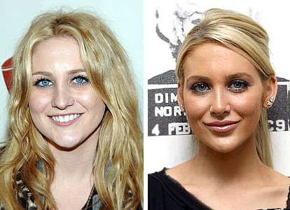 heidi montag surgery before and after. Stephanie Pratt efore and