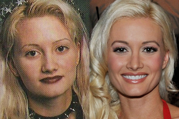  really opened up about her plastic surgery and self confidence issues