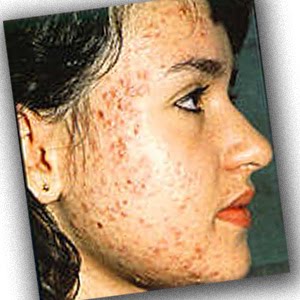 Cara mengedit foto agar terlihat cantik dan cerah