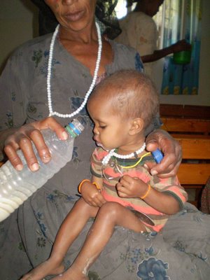 Cuidados de Enfermeria en Niños con Desnutricion Cuidados de Enfermeria en Niños con Desnutricion