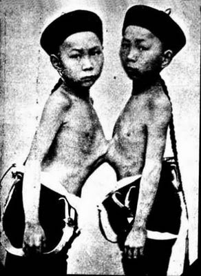 Chang Eng