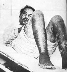 [albizu-campos-torture-radiation-puerto-rico+4.jpg]