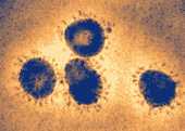[SARS-virus.png]