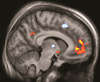 BrainLovePain