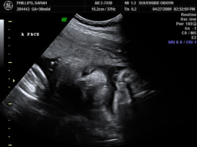 Hair On Ultrasound