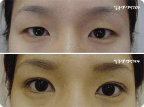 [eye_clinic02_2.gif]