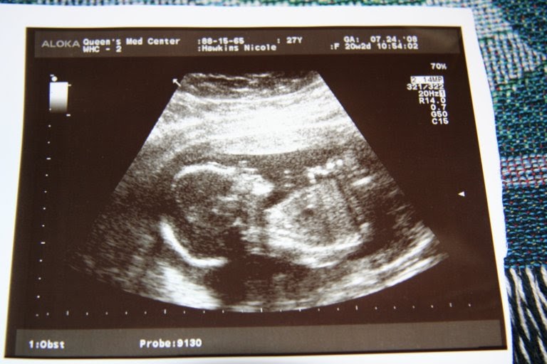 Tim &amp; Nicole 5 month Ultrasound Picture &amp; Baby Bump