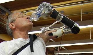 Luke Arm. O braço robótico de Dean Kamen