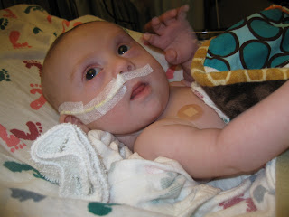 Down Right Living: Jacob broke 10 lbs! He is now heavy enough for heart surgery.