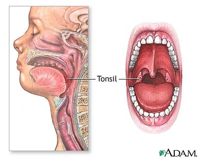 The Tonsils, Appendix