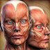 Avaliação clínica da Paralisia Facial