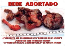 ¿Aborto o infanticidio?