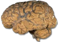[200px-Human_brain_NIH.png]